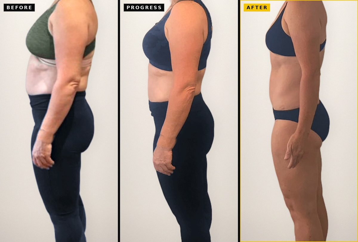 Side view of an online coaching client: before, progress and after